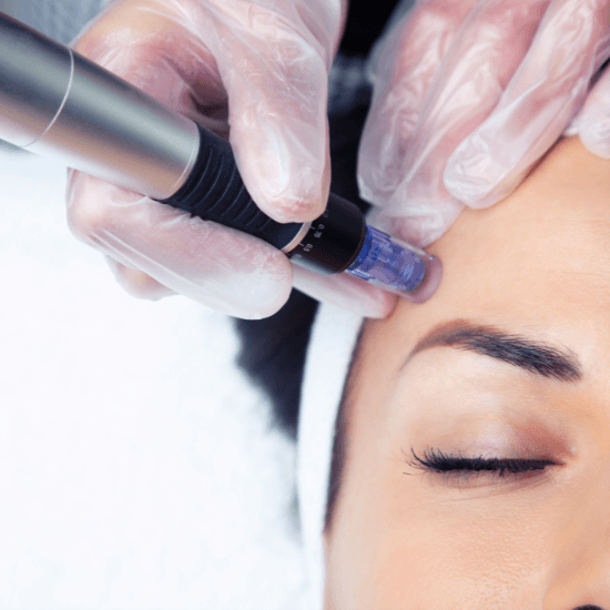 Microneedling Package - Three at Boca Skin and Lash in Boca Raton, FL